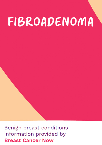 BCC72 Fibroadenoma Thumbnail (Mod)