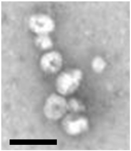 A group of ball-like exosomes, observed with an electron microscope.