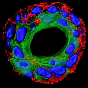 An image of Dr Carter’s DCIS model, observed with a microscope.