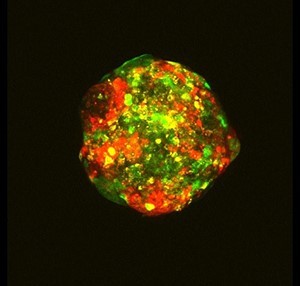 Image of one of Dr Natrajan’s spheroids taken with a microscope, with three cell types