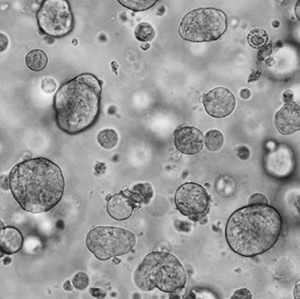 An image showing some of the organoids Rebecca is testing. Each one is about 200 micrometres across – a fifth of a millimetre